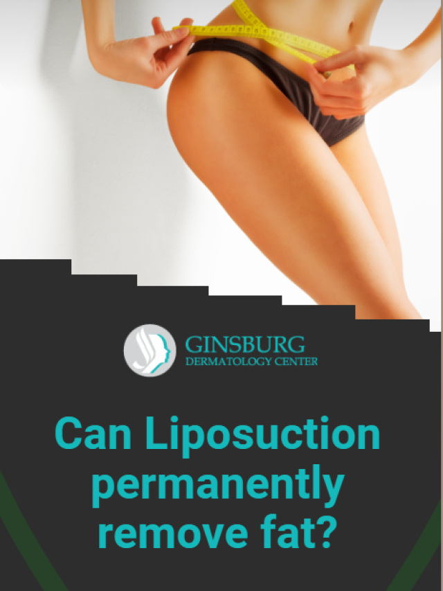 Can liposuction permanently remove fat?